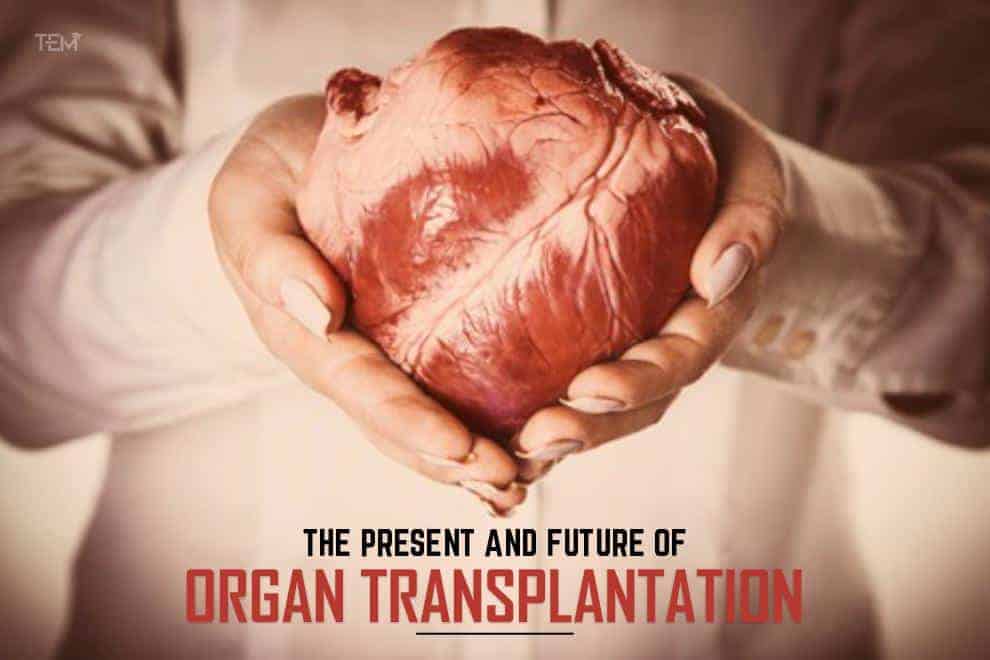 Organ Transplantation